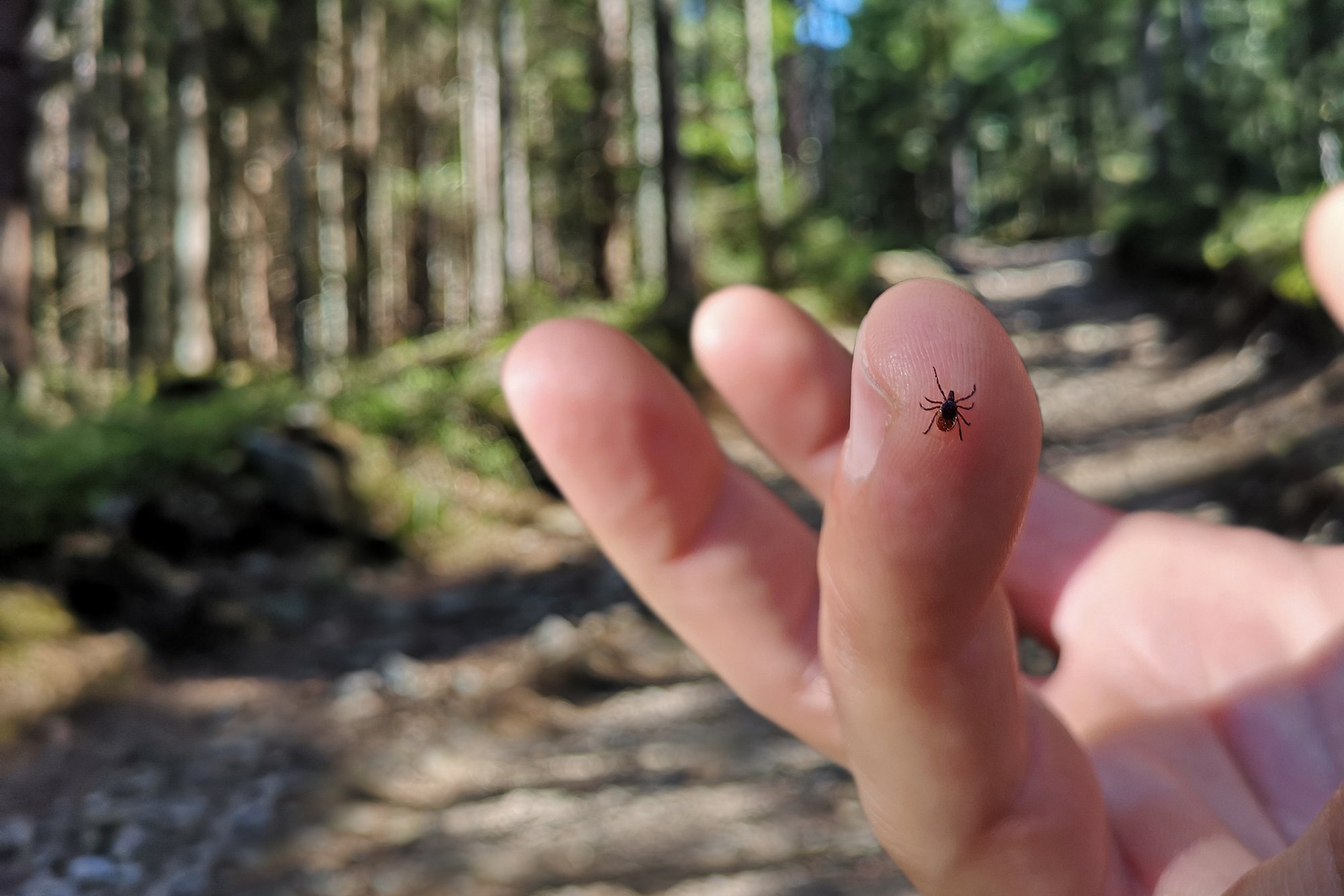 FSME-Infektion durch Zecken Impfung Eine Zecke sitzt auf dem Finger des Menschen, im Hintergrubnd sind die Bäume eines Waldes zu sehen sowie ein Wanderweg.